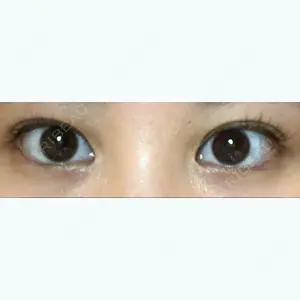 before image