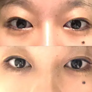 before image