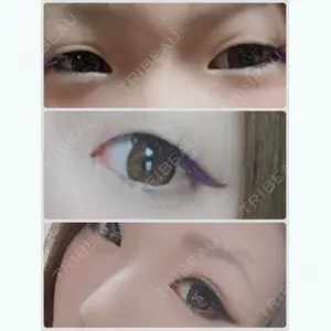 before image