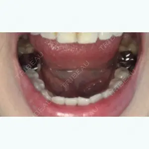 before image