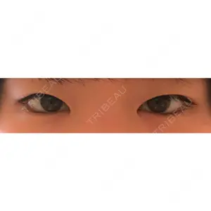 before image