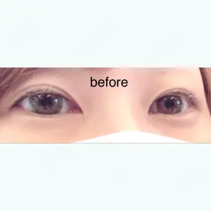 before image