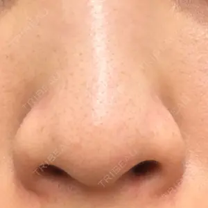口コミ