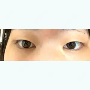 before image