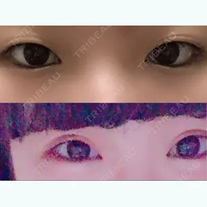 before image