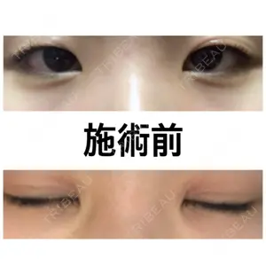 before image