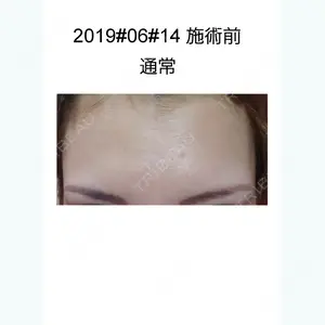 before image