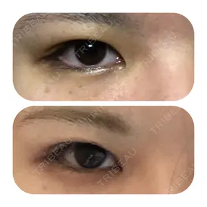 before image