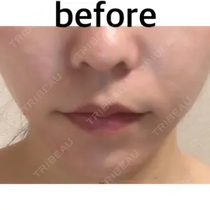before image