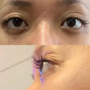 before image