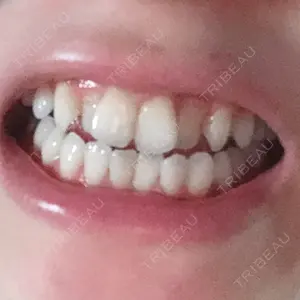 before image