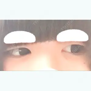 before image