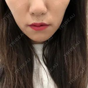 口コミ