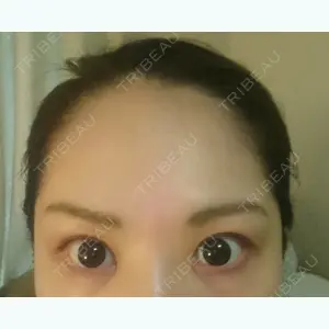 before image