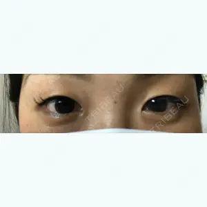 口コミ