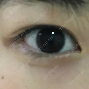before image