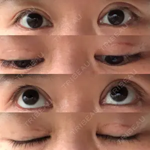 こまちくりにっく口コミ