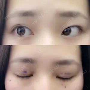 before image