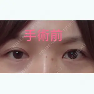 before image