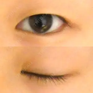 before image