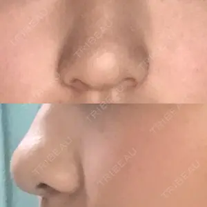 before image