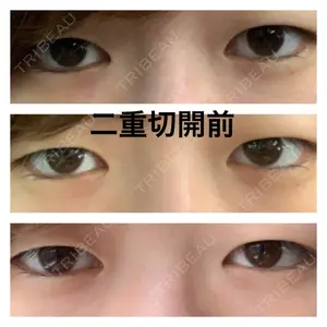 before image