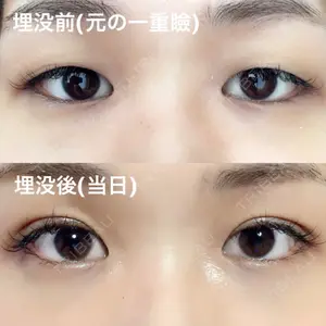 before image
