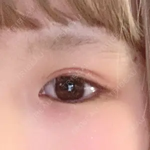 before image