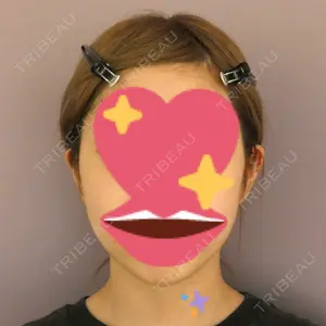 before image
