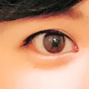 before image