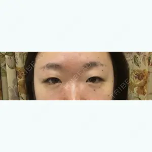 before image