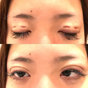 before image