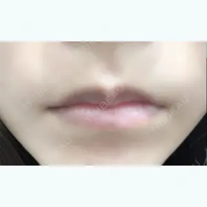 before image