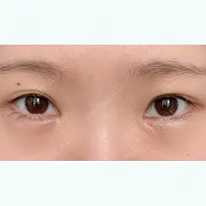 before image