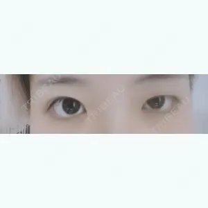 before image