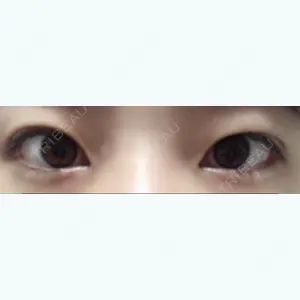 before image