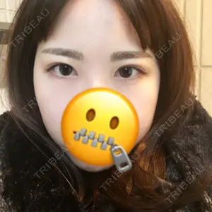 ジュエリー美容外科のシン・ヨンウォン医師口コミ