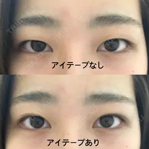 before image