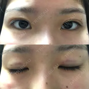 before image