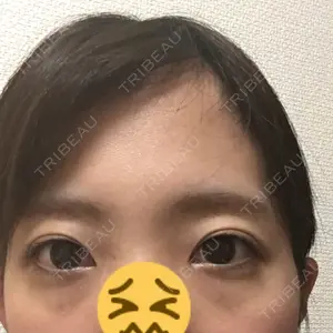 before image