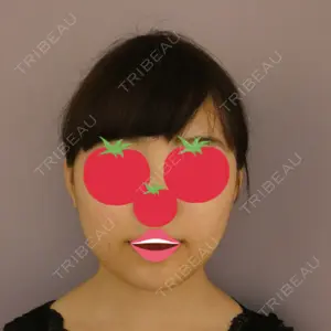before image