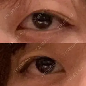 before image