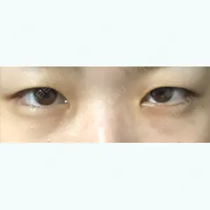 before image