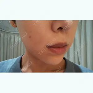 before image