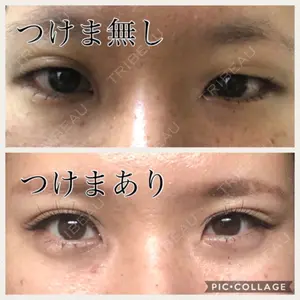 before image