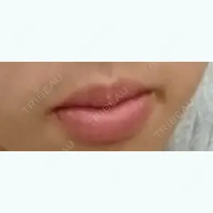 before image