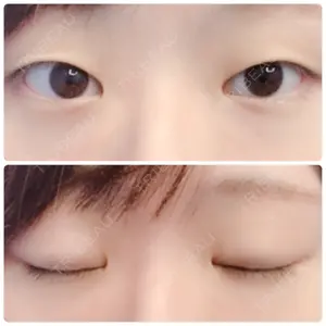 before image