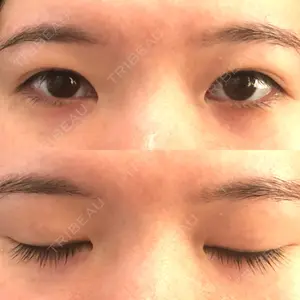 before image