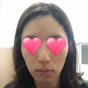 4ever（フォーエバー）美容外科・皮膚科 江南店口コミ