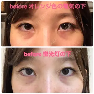 before image
